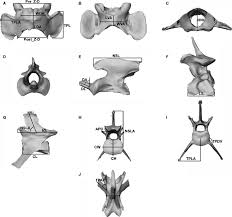 The dens articulates with the atlas and creates a pivot join which allows the head. Vertebral Measurements A C Atlas D And E Axis F C6 G J L2 Download Scientific Diagram