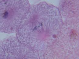 Onion Mitosis