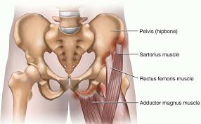Image result for Hip Apophysitis