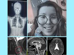 Fundraiser by Michelle Fernandez : Fighting for my Health: Support Me  Through the Unknown Ahead