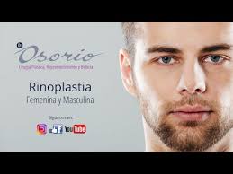RINOPLASTIA