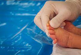 I'll leave their meaning up to you! Babies Born With Extra Fingers And Toes Causes Treatment