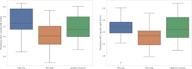 Associations between anterior cingulate thickness, cingulum bundle  microstructure, melancholia and depression severity in unipol