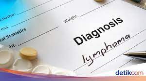 Read more about lymphoma in children or about hodgkin lymphoma. Perbedaan Kanker Limfoma Hodgkin Dan Non Hodgkin