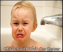 Hair loss experts in denver, natural designs inc. Children With Hair Loss Denver Colorado Kelly