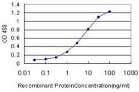 This study aimed to evaluate the life expectancy and the causes of death of patients with bscl. Anti Bscl2 Antibody Aa 259 357 Product No Abin1327202