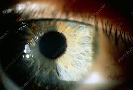 Image result for Slit Lamp