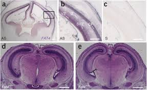 Dexon electrical engineering sdn bhd. Mutations In Genes Encoding The Cadherin Receptor Ligand Pair Dchs1 And Fat4 Disrupt Cerebral Cortical Development Nature Genetics