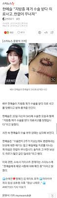 방금 모자이크 없는 사진을 보고 왔는데 너무 심각한것 건강에 문제가 없을지가 더 걱정된다. í•œì˜ˆìŠ¬ ì§€ë°©ì¢… ì œê±° ìˆ˜ìˆ  ë°›ë‹¤ ì˜ë£Œì‚¬ê³  í•œì—†ì´ ë¬´ë„ˆì ¸ ìŠ¤í€˜ì–´ ì¹´í…Œê³ ë¦¬