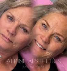 ✨ Hi, I'm Katie! Let me (re)introduce myself! ✨ It's been a while, so I  thought I'd take a moment to share a bit about me and Alpine Aesthetics, my  pride and