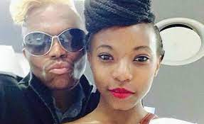 The hardworking, beautiful, and confident actress suffers from a health disorder known as lymphoedema condition. Pin On Celebs South African Celebs