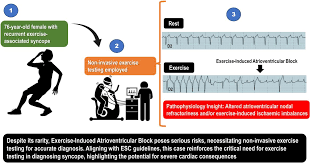 Image result for Exercise Induced Syncope