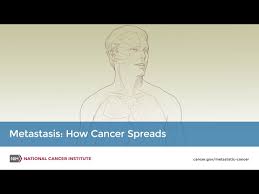 A symptom, such as pain or fatigue, is felt or noticed by the person who has it.; Metastatic Cancer When Cancer Spreads National Cancer Institute
