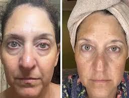 Free skincare analysis and routine for healthy skin