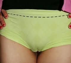 Hey you want to talk about my wife that is ok. Camel Toe Wikipedia