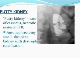 Pin By Kpraveensharma On Others Medical Anatomy Book Projects Radiology