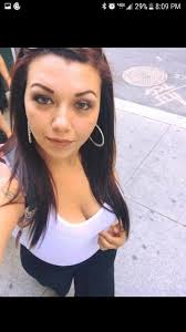 Chelsea's progress with AVM treatment