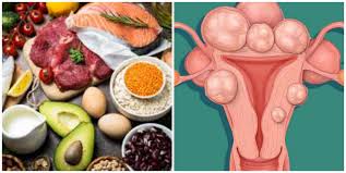 This article goes over symptoms, causes & solutions. Diet Plan For Fibroid Patient In Nigeria Nigerian Health Blog