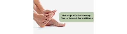 Image result for toe amputation