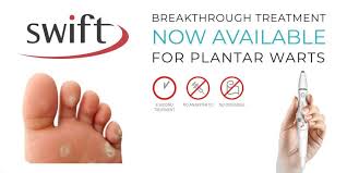 There are many causes, but a mechanical etiology is most common. Swift Wart Treatment Microwave Technology St Catharines Ontario Canadian Foot Clinic Orthotic Centre