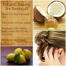 Viral Creek Natural Dandruff Remedy Dandruff Remedy Coconut Oil Hair
