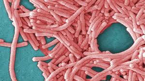 Image result for Legionella