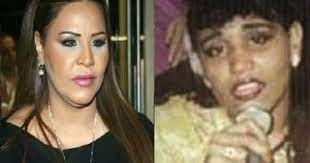 صور الفنانات قبل وبعد عمليات التجميل فضااااايح chain necklace chain fashion