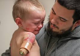 Jeremiah Cox adjusts to new life after quadruple amputation