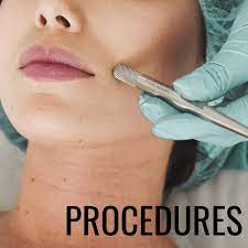 Treatments of melasma include topical, oral, procedural and combination treatments. How To Remove Dark Patches And Spots From Your Face Bellatory