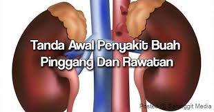 Comments are off for this post related posts. Apa Yang Perlu Kita Tahu Mengenai Penyakit Buah Pinggang Buah Pinggang Adalah Salah Satu Organ Yang Penting Dalam Tubuh Namun Kesihatan Fyi Tanda