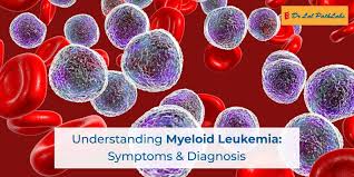 Image result for Acute Leukemia