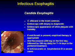 „ odynophagia is the predominant presenting symptom. Esophagus Esophageal Structure Online Presentation
