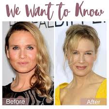 Renee zellweger pens response to plastic surgery rumors: We Want To Know Renee Zellweger S Eyes Prejuvenation