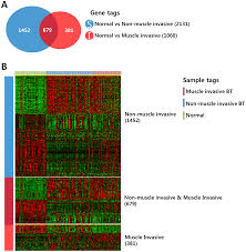 Download 219 bladder cancer ribbon stock illustrations, vectors & clipart for free or amazingly low rates! Plos One Identification Of Pro Inflammatory Cytokines Associated With Muscle Invasive Bladder Cancer The Roles Of Il 5 Il 20 And Il 28a