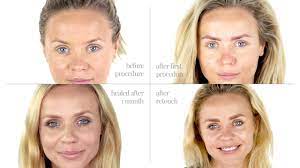 Microblading healing process consists of 6 to 8 weeks. Permanent Powdered Brows For Blonde Client Youtube