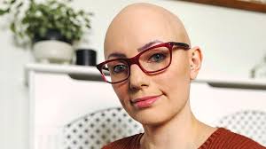 First alopecia treatment recommended