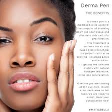 The Benefits Of The Derma Pen Matiabella Dermapen Beauty Beautytrends Bey Derma Pen Beauty Beauty Trends