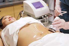 Ultrasonic cavitation works better diet and exercise. Online Ultrasonic Fat Cavitation Rf Certification Fat Cavitation Training