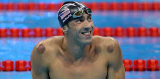 Maybe you would like to learn more about one of these? What Is Cupping Therapy Cupping Therapy Benefits Risks Facts