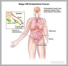 Diagram of groin muscles see more about diagram of groin muscles diagram of female groin muscles diagram of groin injury diagram of groin muscle in human male. Human Body Diagram Groin Human Anatomy