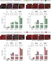 Glucocorticoid intermittence coordinates rescue of energy and mass in  aging-related sarcopenia through the myocyte-autonomous PGC1alpha-Lipin1  transactivation