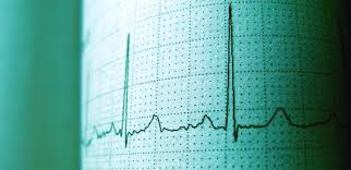 Image result for Electrocardiogram