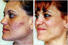 Lisa — VILLANI MEDICAL