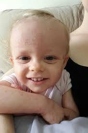 Mum's heartbreak: My little girl is allergic to me