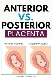 All About The Placenta Everything You Need To Know Diary Of A So Cal Mama In 2020 Placenta Anterior Placenta Placenta Abruption