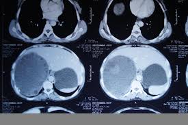 Check spelling or type a new query. Surgery Sixer By Rrm Online Examination Platform