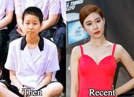 yoo in na jaw surgery before and after celebrity plastic surgery plastic surgery jaw surgery
