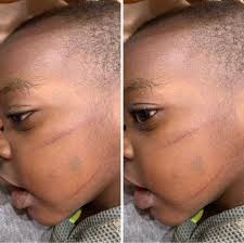 Aye do cockeyed people tears come straight down 😭 or do dey come down  sideways 🤔🤣