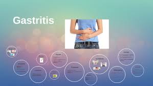 Gastritis By Umaru Bah