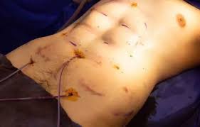 2019년 6월 국제체조연맹이 여서정의 독자 신기술을 채점 규칙집에 올린다고 공식적으로 발표했다. íƒœêµ­ ë³µê·¼ì„±í˜• ì›ƒê¸´ìžë£Œ ë„íƒìŠ¤ Dotax